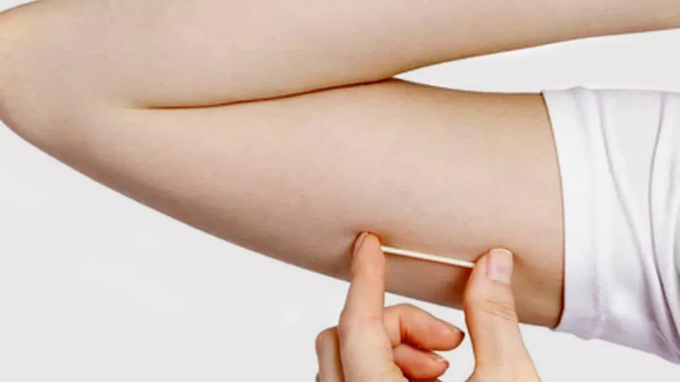 Agência determina que implantes hormonais somente poderão ser prescritos para tratamentos médicos, visando a saúde da população.