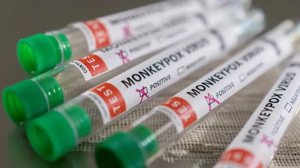 A Organização Mundial da Saúde reitera que o vírus Mpox continua a ser uma emergência de saúde pública de interesse global.
