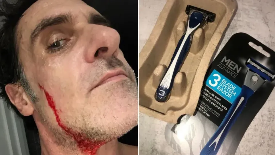 Nick Silverthorn, de 48 anos, sofreu cortes graves e pesadelos após incidente com lâmina solta.