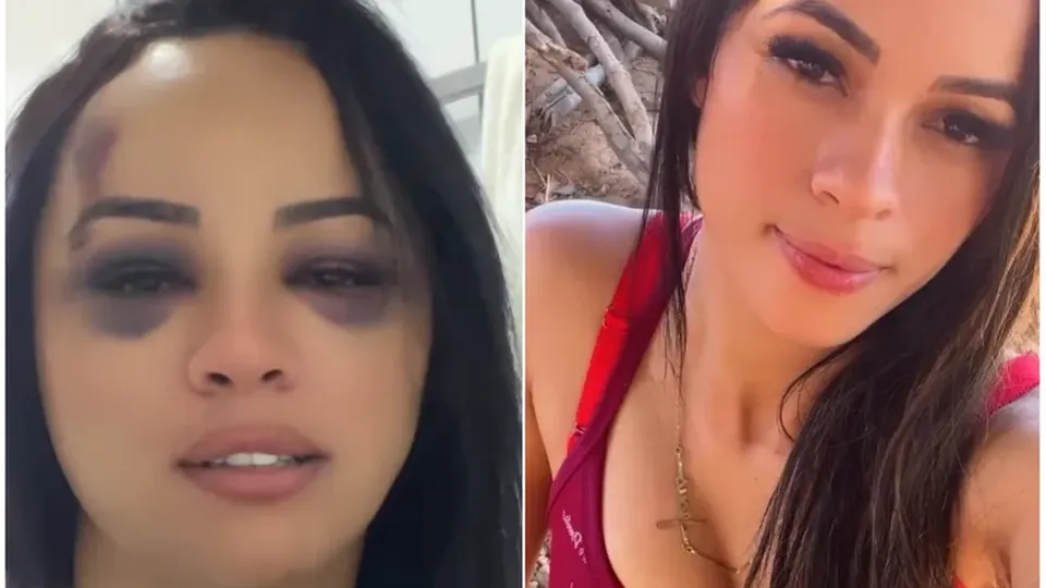 Ana Paula, de 28 anos, foi hospitalizada após o ataque; polícia investiga o caso como violência doméstica