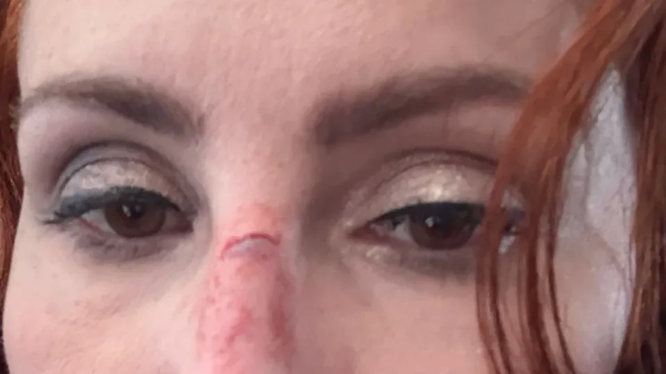Deputada federal Carla Zambelli (PL-SP) se feriu ao ser atingida por painel de banheiro durante viagem aos EUA para posse de Trump.