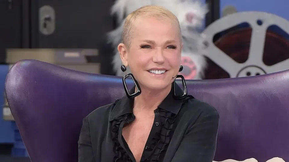 Xuxa Meneghel recebe alta após cirurgia no joelho; detalhes da recuperação