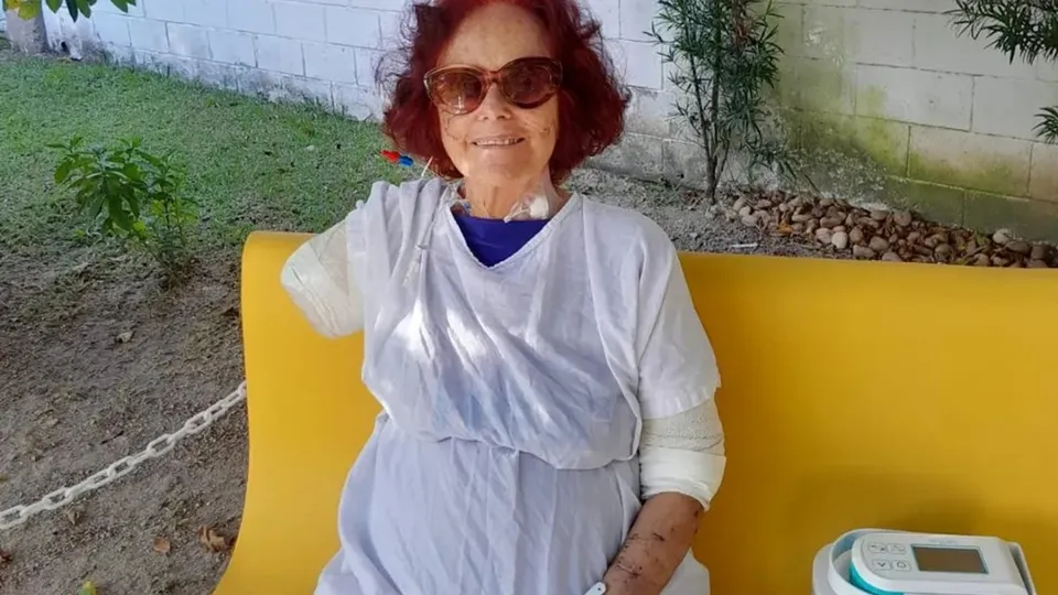 A escritora carioca, que perdeu o braço em ataque de cães, compartilha sua nova rotina com a prótese.