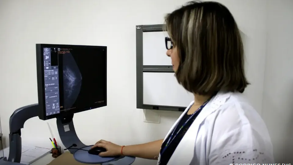 Proposta abrange mulheres de 40 a 74 anos e visa melhorar diagnóstico precoce