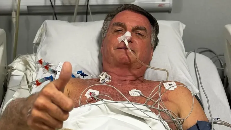 Ex-presidente permanece na UTI do Hospital DF Star, em Brasília, após procedimento complexo na região abdominal.