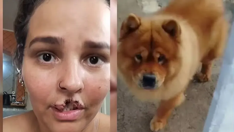 Bebê foi socorrido, mas não resistiu aos ferimentos; mãe e outra mulher ficaram feridas.