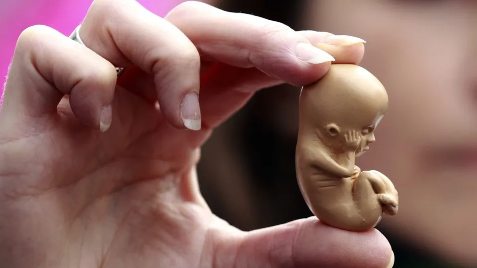 Senado aprova proibição de aborto após 22 semanas, mesmo em casos de estupro