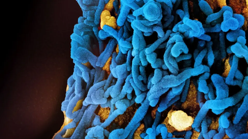 O país africano enfrenta um surto do vírus Marburg, que causa febre hemorrágica e tem alta taxa de letalidade.